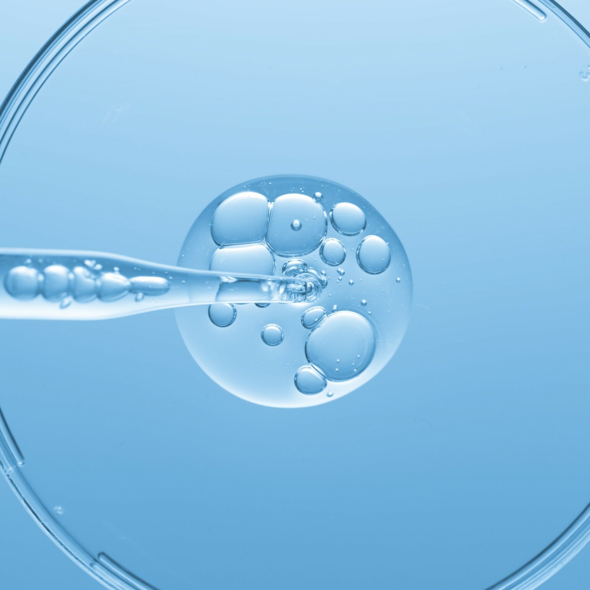 hyaluronic acid market agency consulting consultancy experts