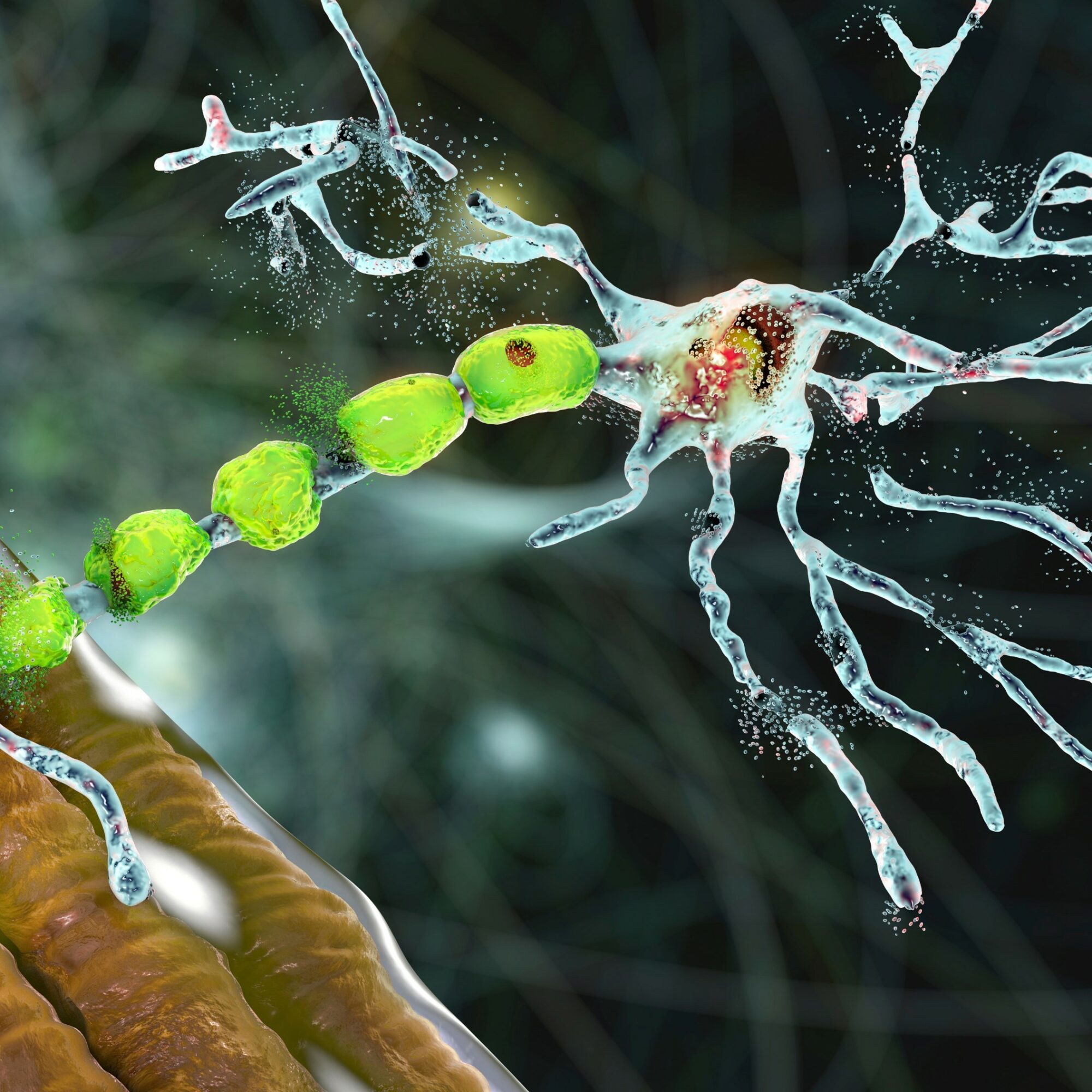 multiple sclerosis agence cabinet conseil consulting