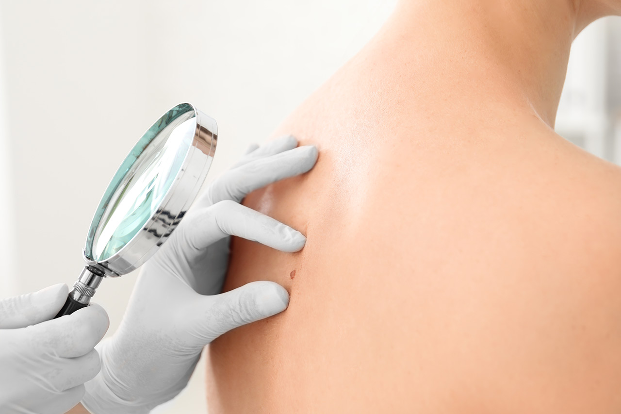 photodynamic therapy agence cabinet conseil consulting